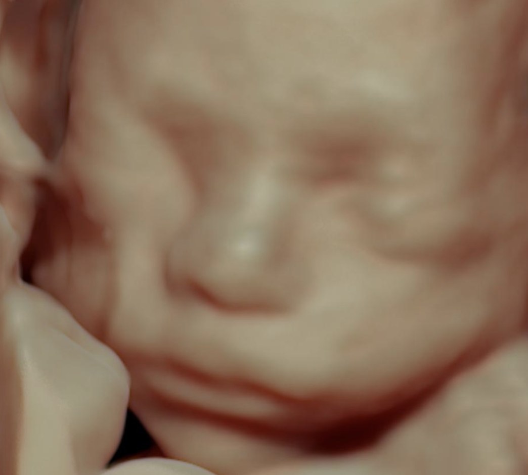 Visage en 3D